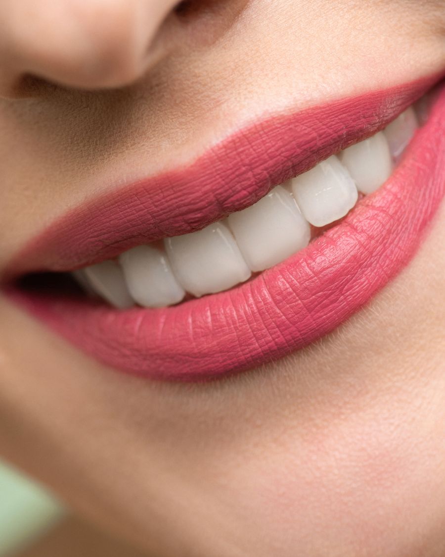 Close-up of a healthy, white smile